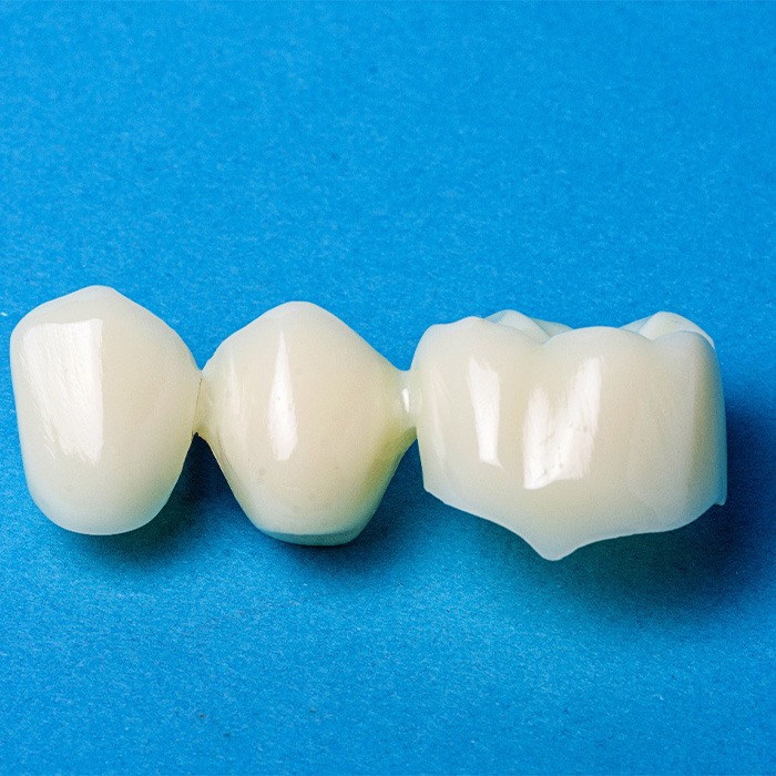 A dental bridge on a blue background.