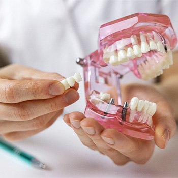 Hands holding sample implant bridge and model jaw with dental implants.