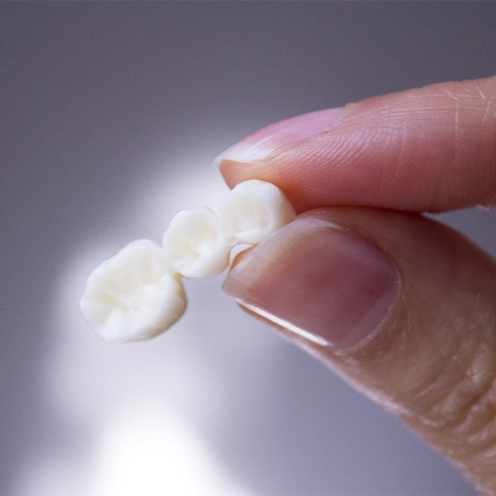 Thumb and forefinger grasping dental bridge.
