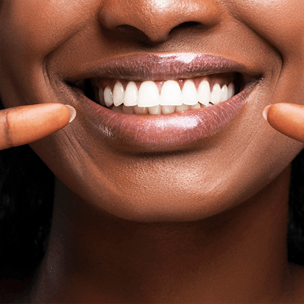 Smiling patient pointing at white teeth