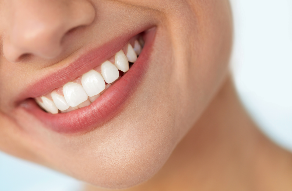 Close up of a woman's smile