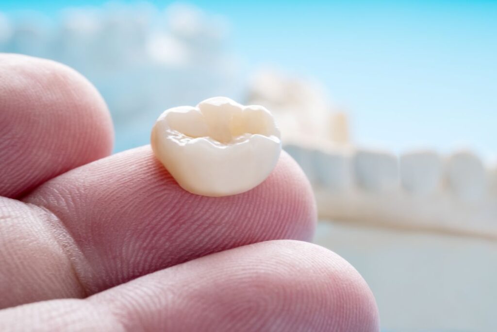 A CEREC dental crown