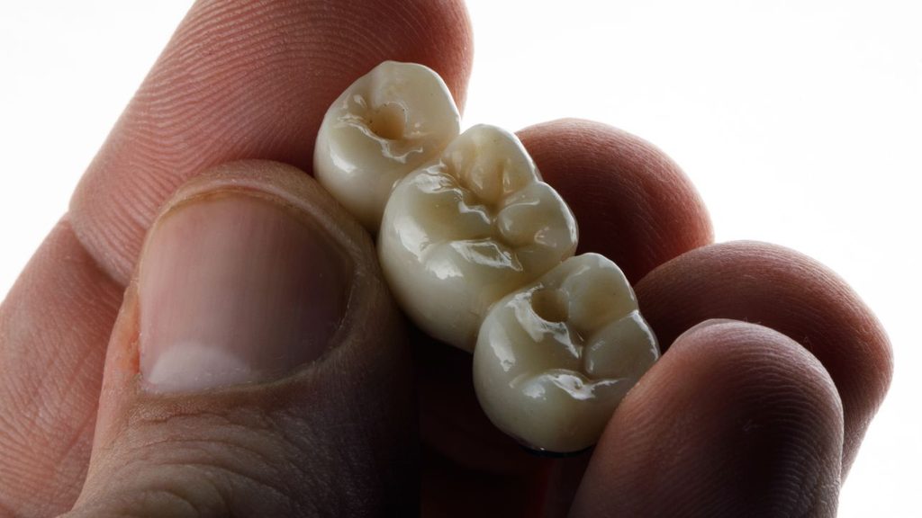 A man’s hand holding a dental bridge